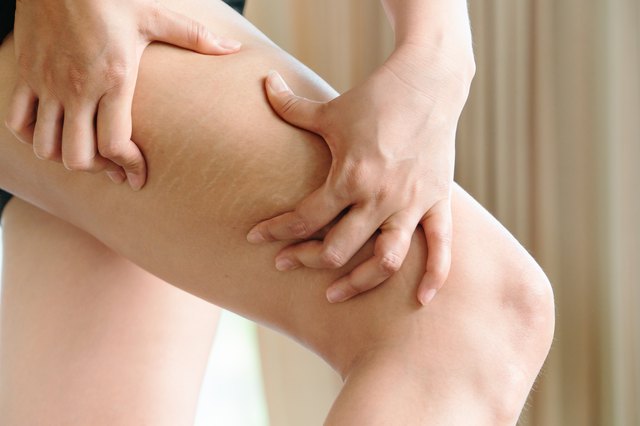 Boils on thighs: What you need to know