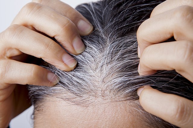 what-causes-white-hair-at-a-young-age-livestrong