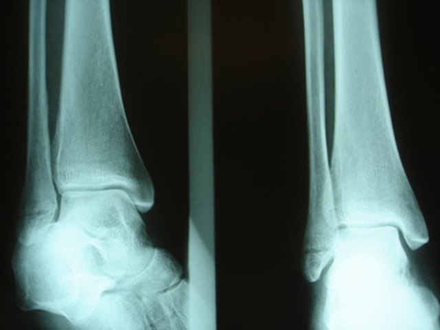 ankle range of motion ankle range of motion