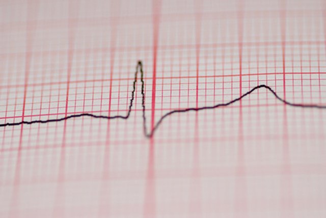 causes-of-pain-in-my-left-arm-chest-livestrong