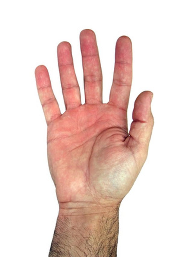 What Does Nerve Damage In Your Hands Feel Like