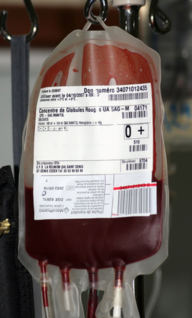 A Blood Transfusion for Anemia | Livestrong.com