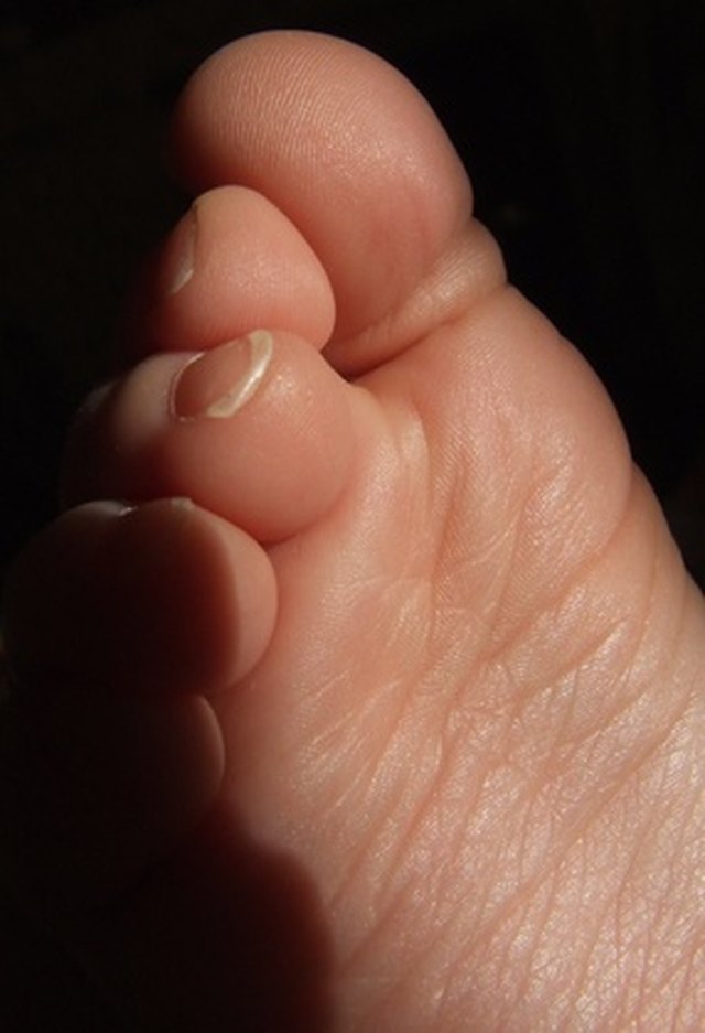 Sharp Tingling Pain In Right Big Toe