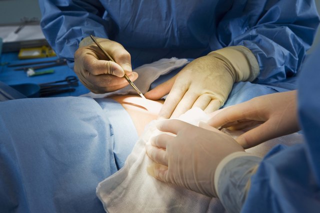 Close-up of medical operation