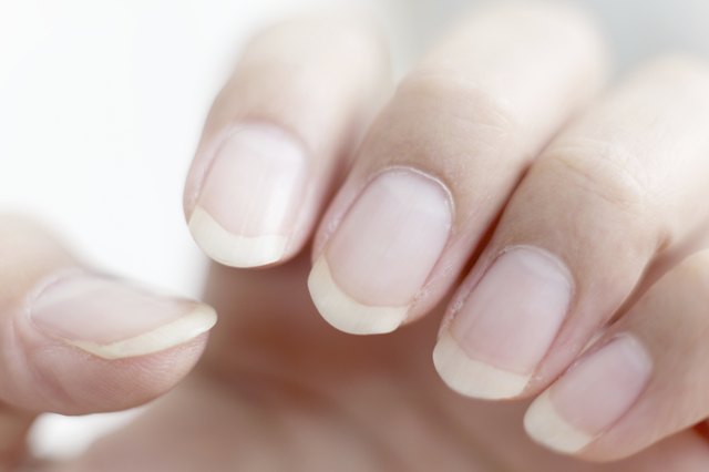 Are Ridged Nails and Dry Skin a Sign of Vitamin Deficiency ...