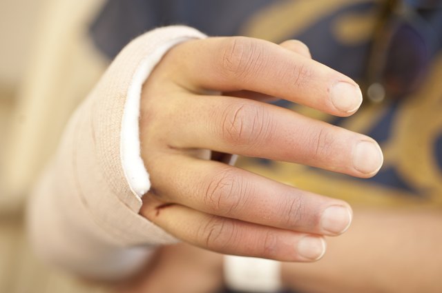 Patient's Hand