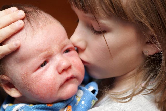 Sister kisses her brother