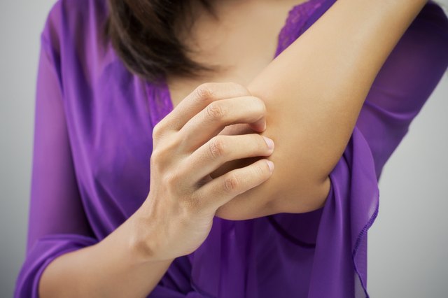 itching