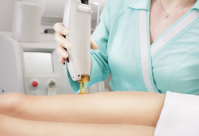 Woman having legs Laser hair removal