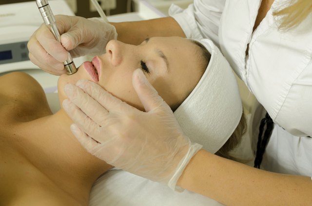 Microdermabrasion treatment