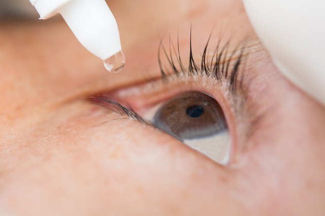 Conjunctivitis in the eye women