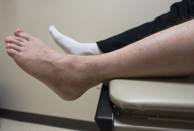 Broken Foot, Sprained Ankle, Fractured Bone in Doctor's Exam Room