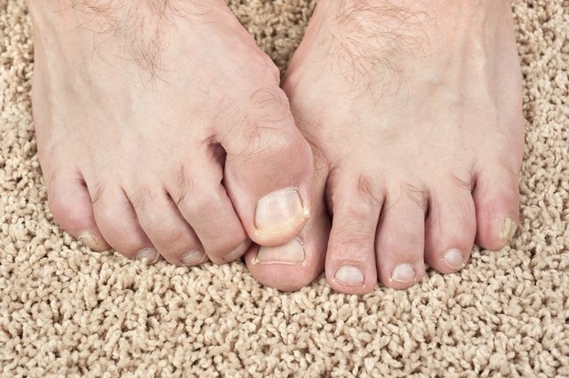 would-a-vitamin-deficiency-cause-split-toenails-livestrong