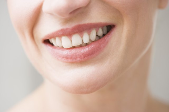 How To Get Rid Of Calcification On Your Teeth Livestrong