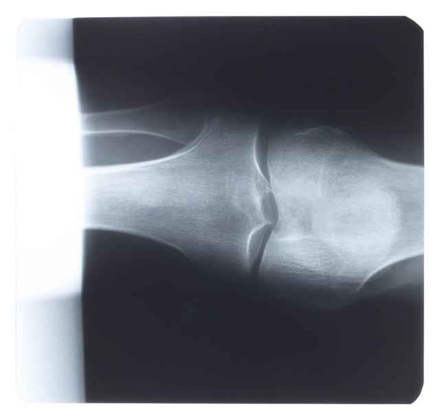 X-ray of leg joint