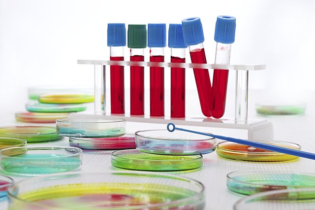 blood sample and petri dish for laboratory research