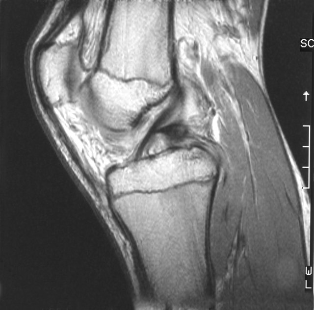 Scan of a human knee