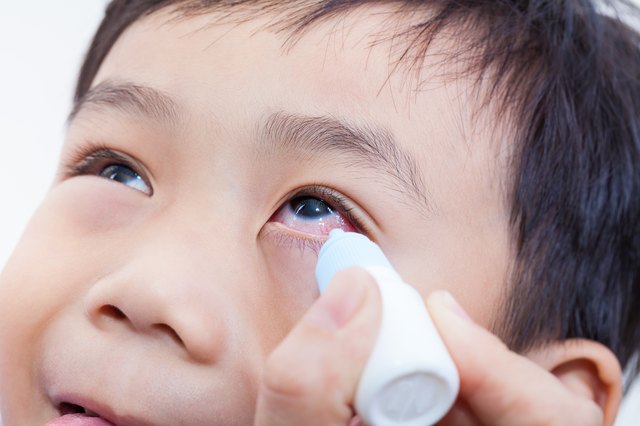 Closeup of parent pouring eye drops in eye her son