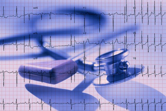 catheter ablation flutter catheter ablation flutter