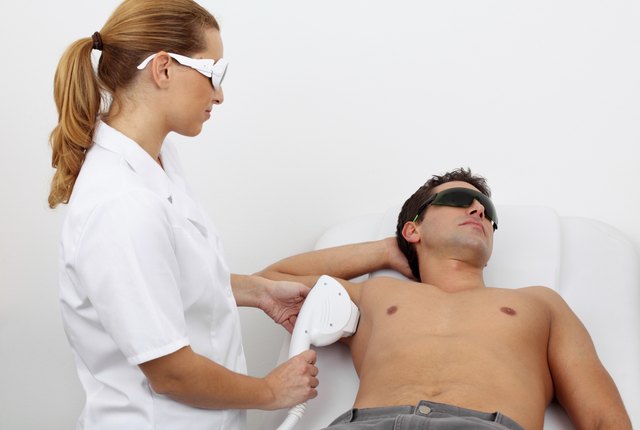 laser hair removal