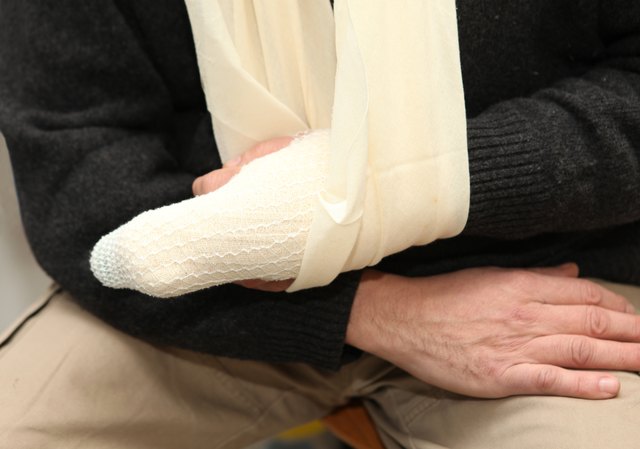 Broken finger