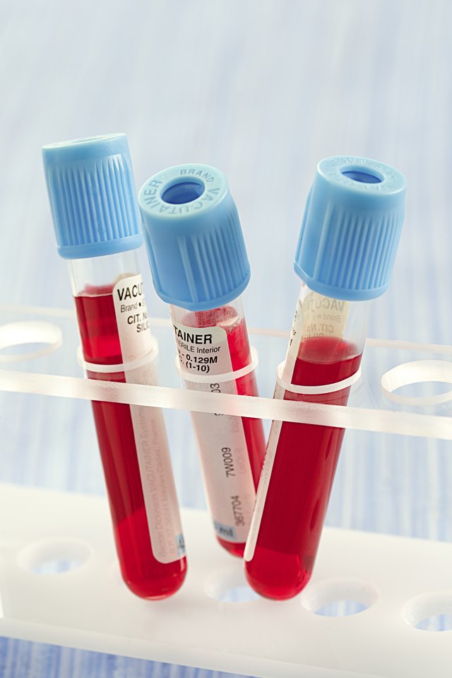 Blood collection
