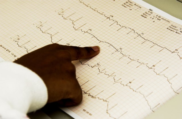 causes-of-abnormal-ekg-results-livestrong