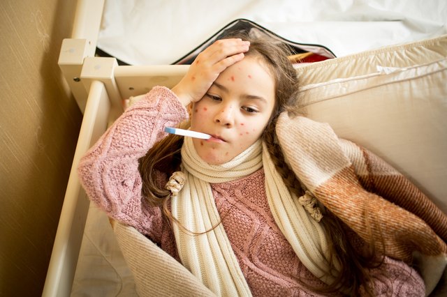sick girl with chickenpox lying in bed and measuring temperature