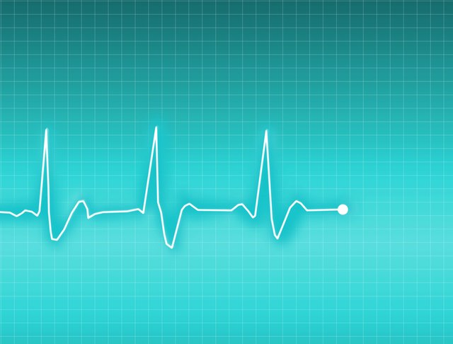 ECG