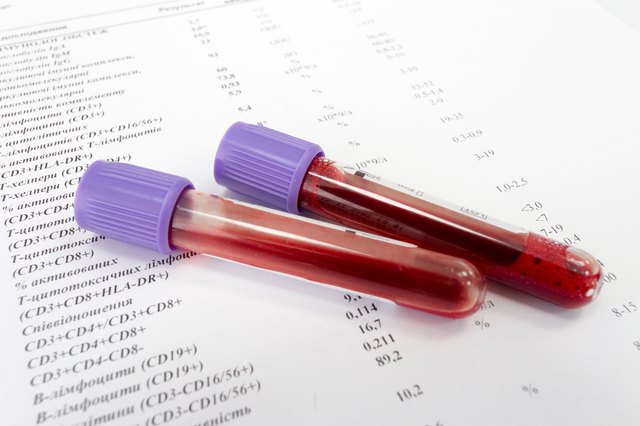 Test tubes with blood on blank with normal results