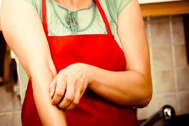 Woman scratching itchy arm. Allergy.