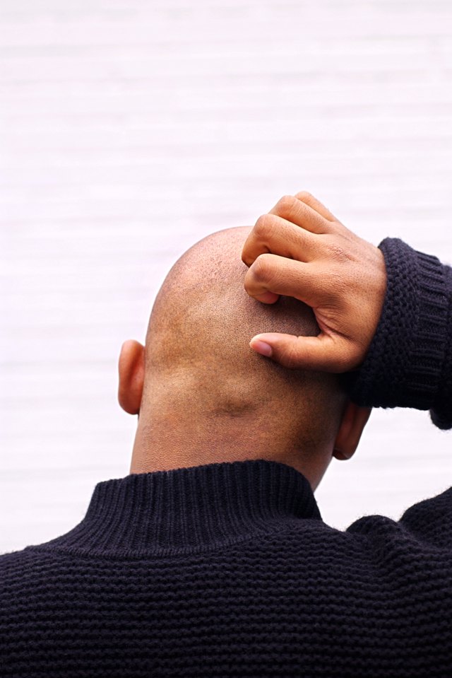 Bald man scratching head