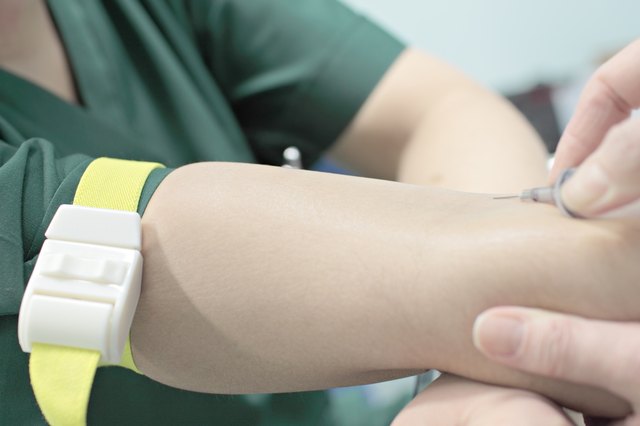 the process of vein puncture