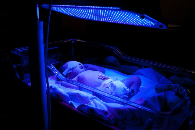 How Phototherapy Works on Jaundice  Livestrong.com