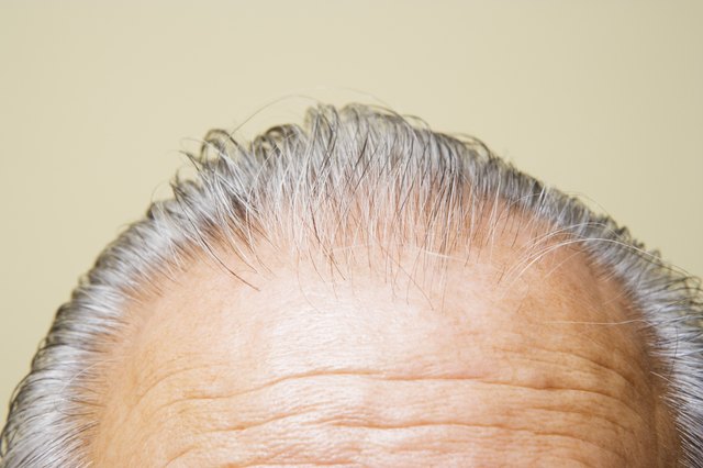Close up of grey hair on top of elderly man's head