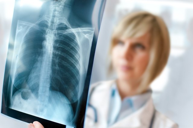 Female doctor examining an x-ray image