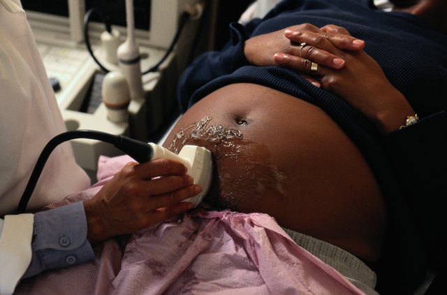 Ultrasound