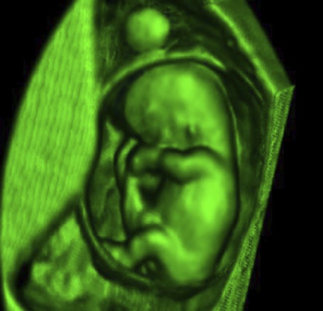 embryo