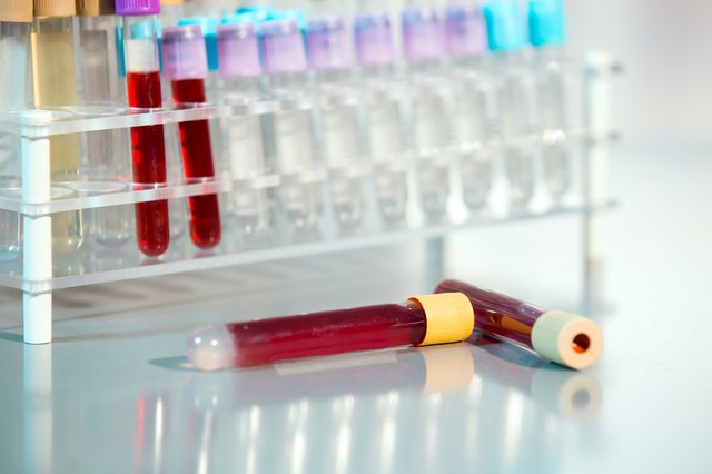 Test tubes