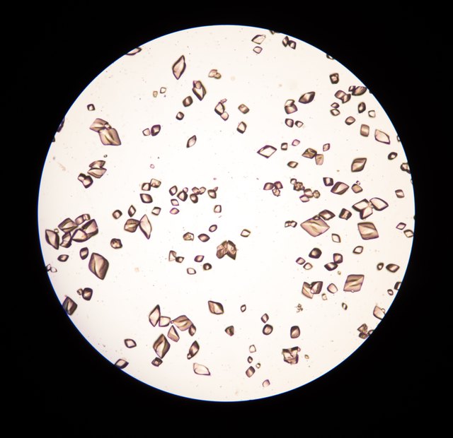 Осадки мочи под микроскопом в картинках крупным планом