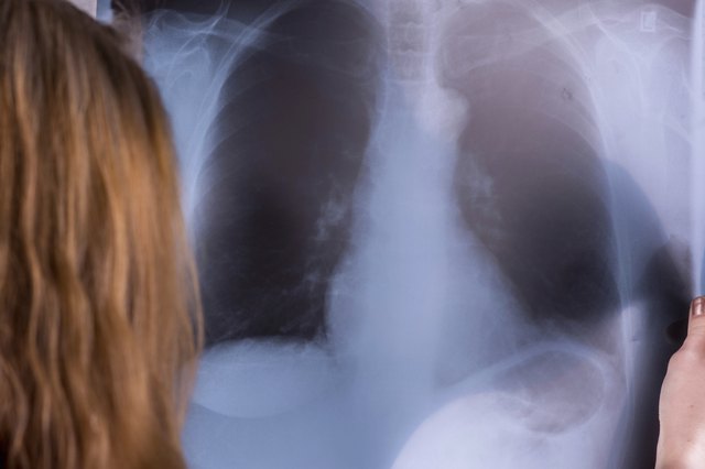 Young doctors consult over an X-ray