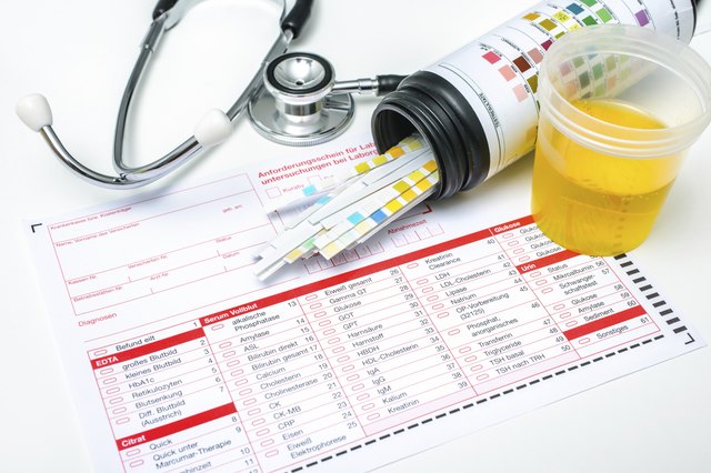Urine test strips