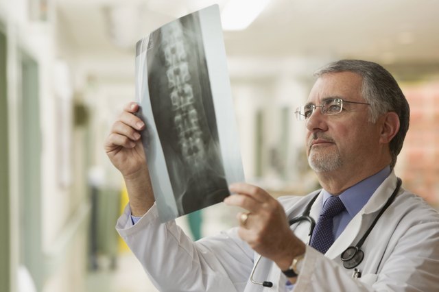 Elderly doctor looking at x-rays