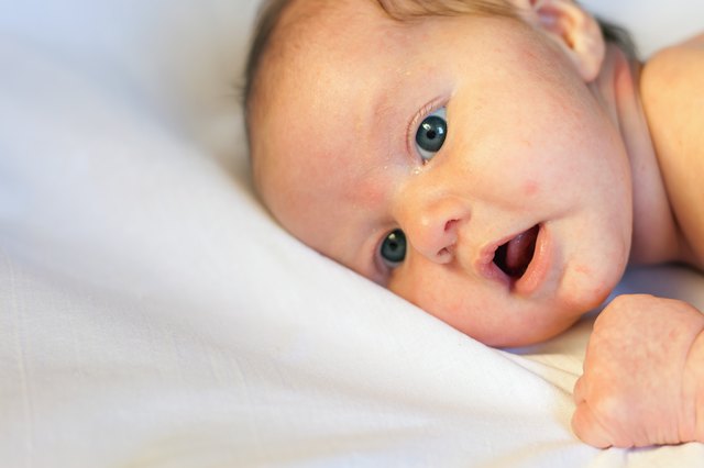 What Causes Pimples On A Baby s Ears Livestrong what-causes-pimples-on-a-baby-s-ears-livestrong