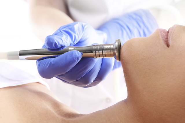 Dermabrasion