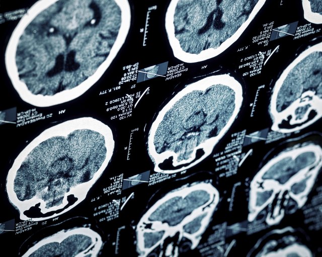 MRI scan head sections
