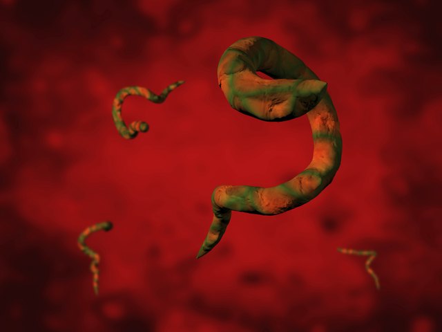 Signs of Intestinal Worms in Humans | Livestrong.com