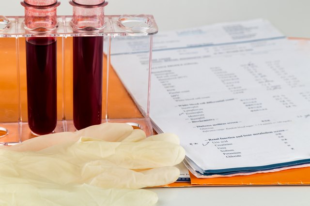 Blood sample in test tubes with health analysis screening report
