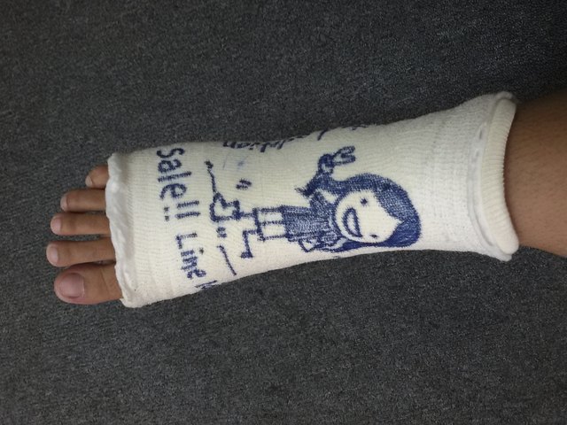 Art on soft splint
