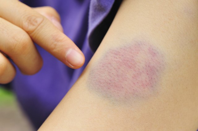 domestic violence